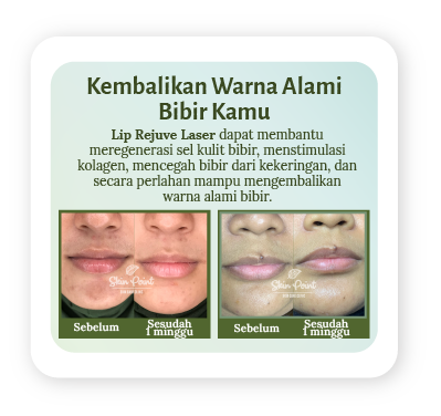 banner before after revv-02