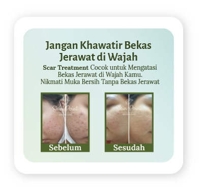 banner before after revv-03